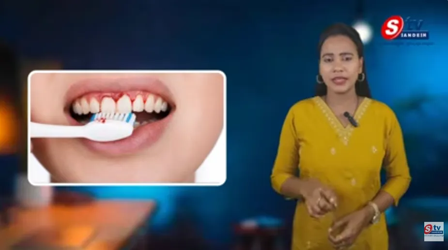 బ్రష్ చేసేటప్పుడు మీ చిగుళ్ల నుంచి రక్తం వస్తుందా? | హెల్త్ ఈజ్ ఇన్ అవర్ హ్యాండ్స్ | సందేశ్ టీవీ